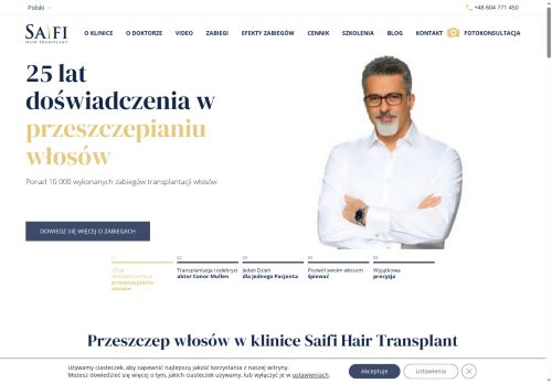 transplantacja-wlosow.pl